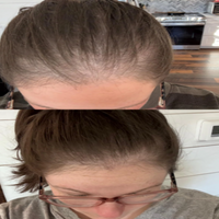 elysiv Liquid Multivitamin and Hair Growth Syrup